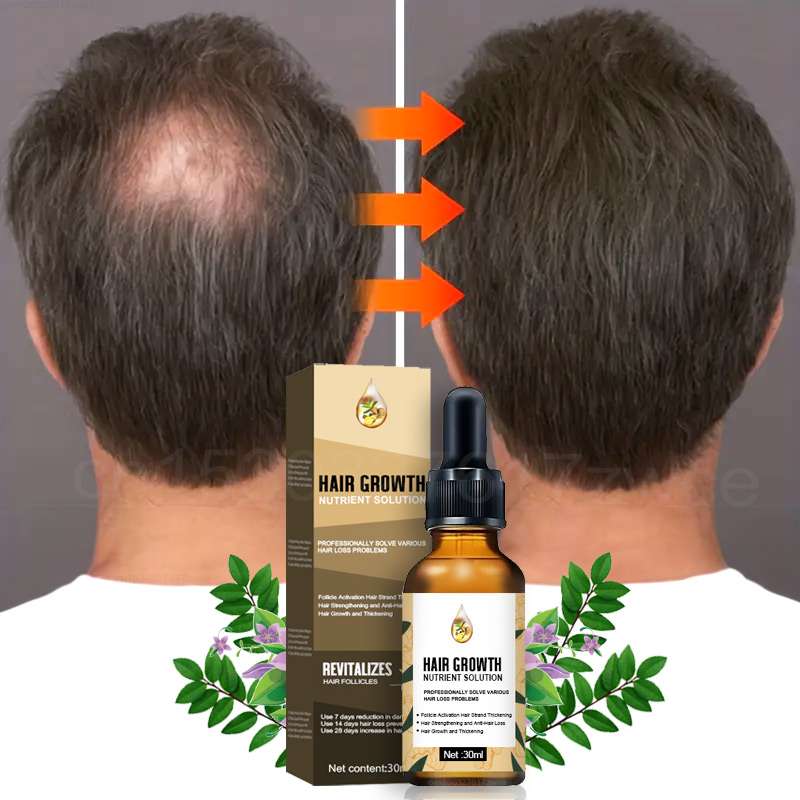 Biotin Hair Growth - Snelle Haargroei Mannen Vrouwen Gembergroei Haarolie