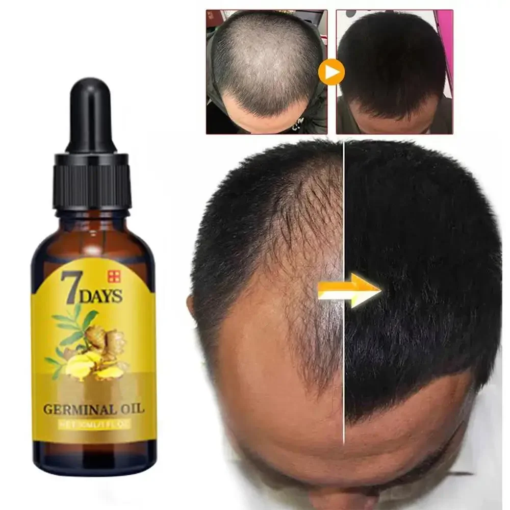 Biotin Hair Growth - Haargroei Gember Snelgroeiend haar Essentiële olie