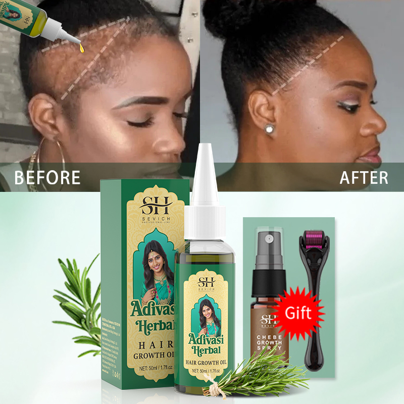 Ayurvedische haargroeiolie Ind - Biotin Hair Growth recensie en prijs
