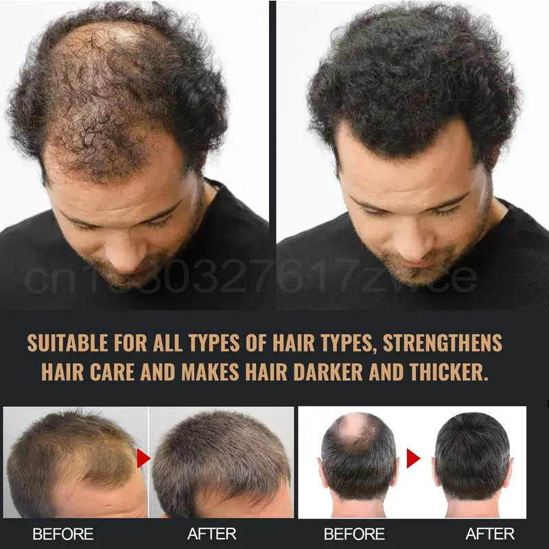 Snelle Haargroei Mannen Vrouwe - Biotin Hair Growth recensie en prijs