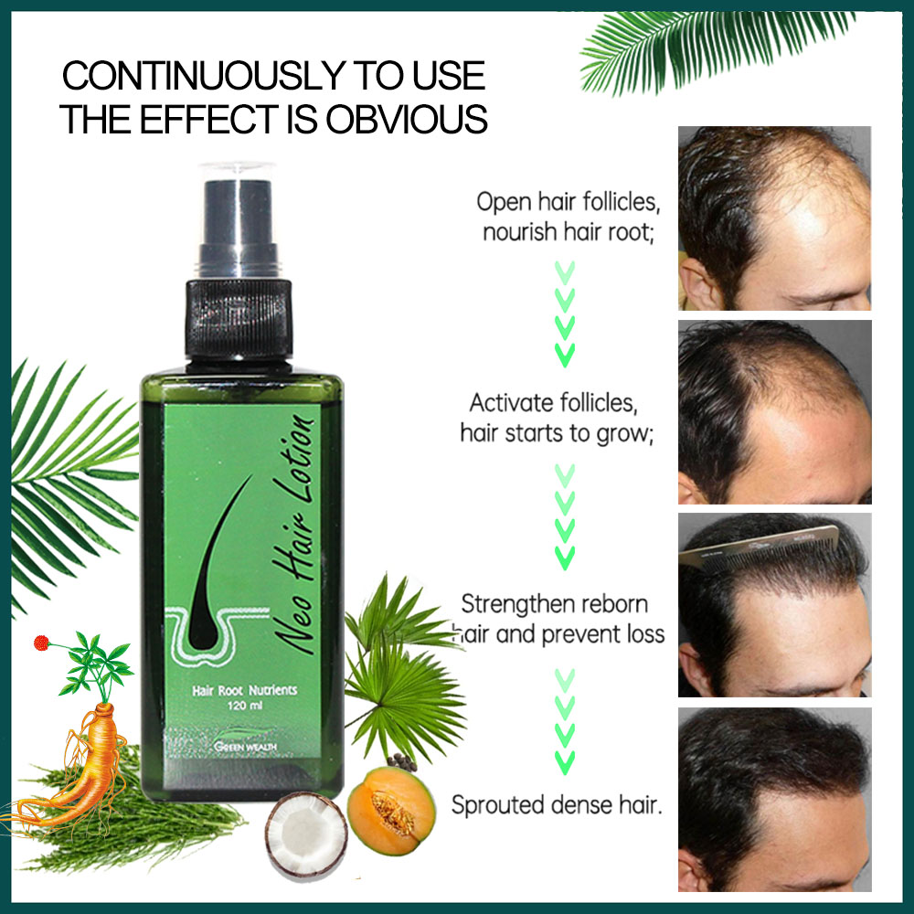4 stuks Neo Haar Lotion 120ml  - Biotin Hair Growth recensie en prijs