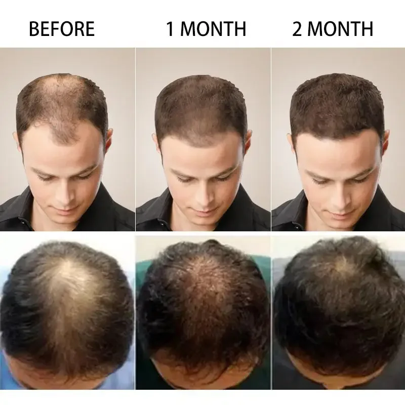 Haargroei Gember Snelgroeiend  - Biotin Hair Growth recensie en prijs
