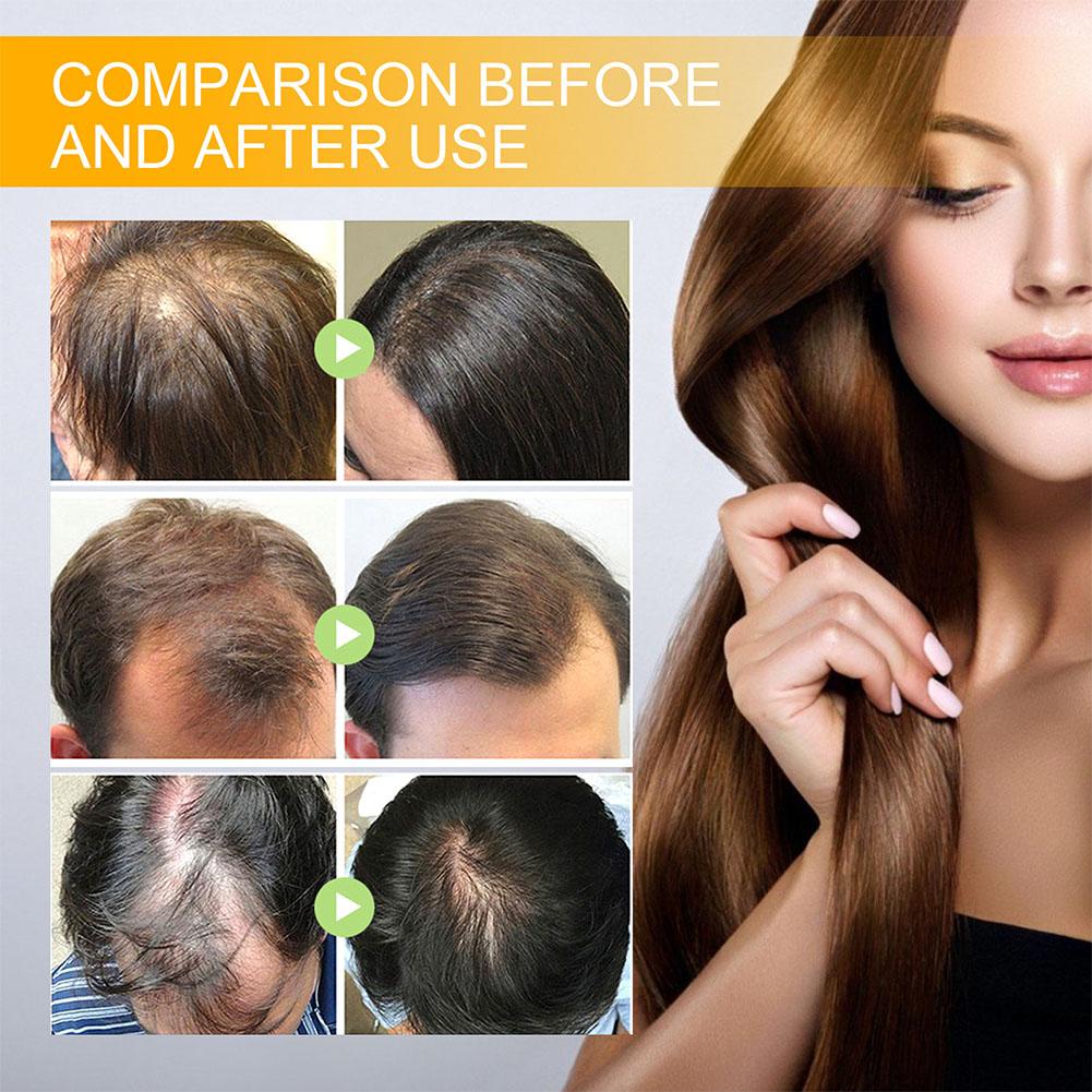 5/3/1pcs Biotine Snelle Haargr - Biotin Hair Growth recensie en prijs